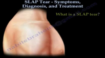 SLAP Tear Symptoms Diagnosis And Treatment  Everything You Need To Know  Dr. Nabil Ebraheim