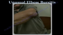 Unusual Bursitis Of The Elbow  Everything You Need To Know  Dr. Nabil Ebraheim