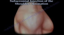 Shoulder bursitis, Tendonitis Injection Animation  Everything You Need To Know  Dr. Nabil Ebraheim
