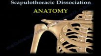 Scapulothoracic Dissociation  Everything You Need To Know  Dr. Nabil Ebraheim