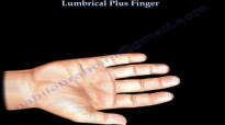 Lumbrical Plus Finger  Everything You Need To Know  Dr. Nabil Ebraheim