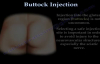 Buttock Injection  Everything You Need To Know  Dr. Nabil Ebraheim