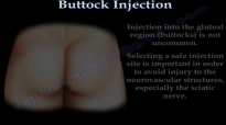Buttock Injection  Everything You Need To Know  Dr. Nabil Ebraheim