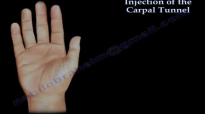 Carpal Tunnel Injection  Everything You Need To Know  Dr. Nabil Ebraheim