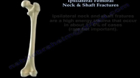 Ipsilateral Femoral Neck & Shaft Fractures  Everything You Need To Know  Dr. Nabil Ebraheim