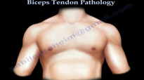 Biceps Tendon Pathology  Everything You Need To Know  Dr. Nabil Ebraheim
