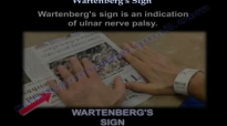 Wartenbergs Sign  Everything You Need To Know  Dr. Nabil Ebraheim