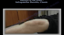 Knee Bursitis Infrapatellar Bursitis Classic  Everything You Need To Know  Dr. Nabil Ebraheim