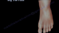 Big Toe Pain  Everything You Need To Know  Dr. Nabil Ebraheim