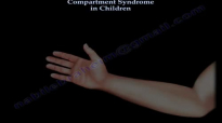 Compartment Syndrome In Children  Everything You Need To Know  Dr. Nabil Ebraheim