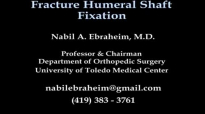 Humeral Shaft fracture Fixation  Everything You Need To Know  Dr. Nabil Ebraheim