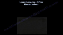 Lumbosacral Disc Herniation ,low back pain Everything You Need To Know  Dr. Nabil Ebraheim