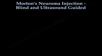 Mortons Neuroma Injection  Everything You Need To Know  Dr. Nabil Ebraheim