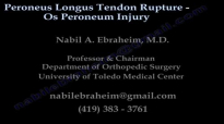 Peroneus Longus Tendon Rupture Os Peroneum Injury  Everything You Need To Know  Dr. Nabil Ebraheim