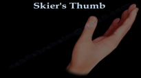 Skiers Thumb Gamekeepers Thumb  Everything You Need To Know  Dr. Nabil Ebraheim