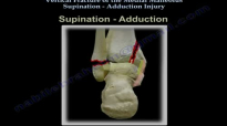 Vertical Fracture Of The Medial Malleolus  Everything You Need To Know  Dr. Nabil Ebraheim