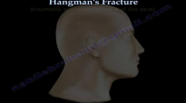 Hangmans Fracture  Everything You Need To Know  Dr. Nabil Ebraheim
