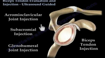 Biceps Tendon Evaluation, Injection Ultrasound  Everything You Need To Know  Dr. Nabil Ebraheim