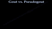 Gout and Pseudogout, Joint Pain Everything You Need To Know Dr. Nabil Ebraheim