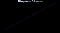 Iliopsoas Abscess infection, A Diagnostic Dilemma  Everything You Need To Know  Dr. Nabil Ebraheim