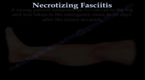 Necrotizing Fasciitis part I, flesh eating bacteria.Everything You Need To Know  Dr. Nabil Ebraheim