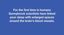 Poor sleep may affect brain's ability to clear waste .mp4