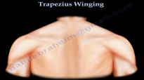 Trapezius Winging  Everything You Need To Know  Dr. Nabil Ebraheim