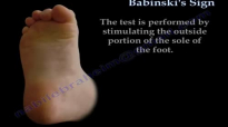 Babinskis Sign  Everything You Need To Know  Dr. Nabil Ebraheim