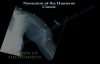NONUNION Of The Humerus Classic  Everything You Need To Know  Dr. Nabil Ebraheim