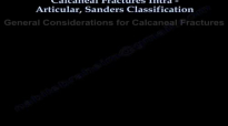 Calcaneal IntraArticular Fractures, Sanders  Everything You Need To Know  Dr. Nabil Ebraheim