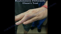 Boutonniere Deformity Elsons Test  Everything You Need To Know  Dr. Nabil Ebraheim