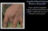 Sagittal Band Injury Boxers Knuckle  Everything You Need To Know  Dr. Nabil Ebraheim