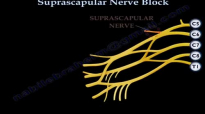 Shoulder Pain Injection Suprascapular Nerve Block  Everything You Need To Know  Dr. Nabil Ebraheim