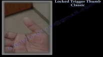 locked Trigger Thumb Classic  Everything You Need To Know  Dr. Nabil Ebraheim