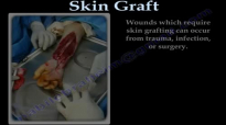 SKIN GRAFT  PART 1 . EVERYTHING YOU NEED TO KNOW  DR. NABIL EBRAHEIM