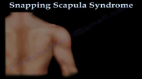 Snapping Scapula Syndrome  Everything You Need To Know  Nabil Ebraheim