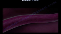 Diabetic HbA1c  Everything You Need To Know  Dr. Nabil Ebraheim