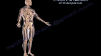 Vitamin C & Treatment Of Osteoporosis  Everything You Need To Know  Dr. Nabil Ebraheim