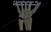 Hamate Fractures  Everything You Need To Know  Dr. Nabil Ebraheim