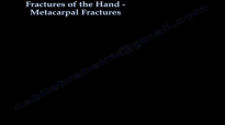 Metacarpal Fractures  Everything You Need To Know  Dr. Nabil Ebraheim
