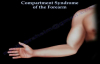Compartment Syndrome Of The Forearm  Everything You Need To Know  Dr. Nabil Ebraheim