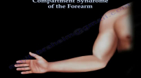 Compartment Syndrome Of The Forearm  Everything You Need To Know  Dr. Nabil Ebraheim