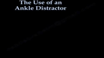 ANKLE ARTHROSCOPY,The Use Of Ankle Distractor  Everything You Need To Know  Dr. Nabil Ebraheim