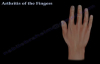 Arthritis Of The Fingers types and patterns  Everything You Need To Know  Dr. Nabil Ebraheim