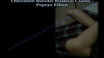 Bilateral, Olecranon Bursitis Popeye Elbow ClassicEverything You Need To Know  Dr. Nabil Ebraheim