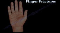 Finger and metacarpal Fractures  Everything You Need To Know  Dr. Nabil Ebraheim