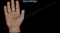 Quadriga  Everything You Need To Know  Dr. Nabil Ebraheim
