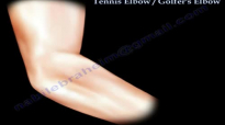 Tennis Elbow  Golfers Elbow  Everything You Need To Know  Dr. Nabil Ebraheim