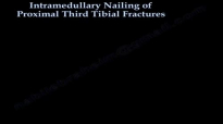Intramedullary Nailing Proximal Tibial Fractures  Everything You Need To Know  Dr. Nabil Ebraheim