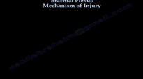 Brachial Plexus Mechanism Of Injury  Everything You Need To Know  Dr. Nabil Ebraheim